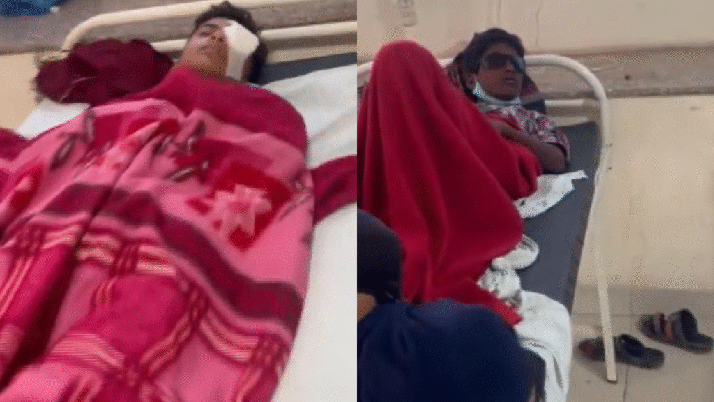 MP में चौंकाने वाली खबर! कार्बाइड गन का इस्तेमाल करने से 14 बच्चों की आंखों की रोशनी गई