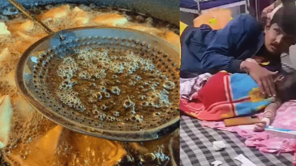 MP News : गर्म समोसे के बर्तन में गिरा बच्चा; दादी ने बच्चे को बचाने के लिए खौलते तेल में हाथ डाले
